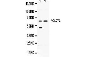 Western blot analysis of ACADVL expression in rat liver extract ( Lane 1) and HELA whole cell lysates ( Lane 2).