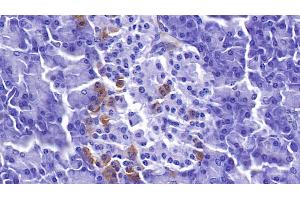 Detection of PDLIM1 in Human Pancreas Tissue using Polyclonal Antibody to PDZ And LIM Domain Protein 1 (PDLIM1) (PDLIM1 antibody  (AA 2-329))