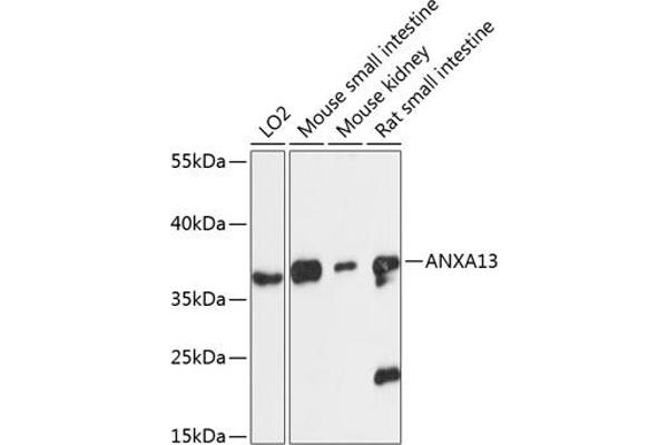 Annexin A13 Antikörper  (AA 1-316)