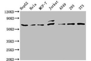 Western Blot Positive WB detected in: HepG2 whole cell lysate, Hela whole cell lysate, MCF-7 whole cell lysate, Jurkat whole cell lysate, A549 whole cell lysate, 293 whole cell lysate, NIH/3T3 whole cell lysate All lanes: c-FOS antibody at 0. (Recombinant c-FOS antibody)