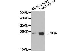 Western blot analysis of extracts of mouse lung and mouse liver cells, using C1QA antibody. (C1QA antibody)
