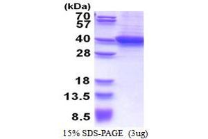 SDS-PAGE (SDS) image for Retinaldehyde Binding Protein 1 (RLBP1) (AA 1-317) protein (His tag) (ABIN5853497) (RLBP1 Protein (AA 1-317) (His tag))