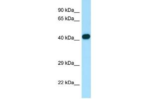 Western Blotting (WB) image for anti-Actin Related Protein 2/3 Complex, Subunit 1B, 41kDa (ARPC1B) (C-Term) antibody (ABIN2790242)