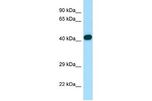 WB Suggested Anti-ARPC1B Antibody Titration: 1.