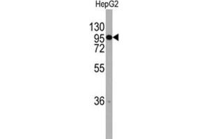 Western Blotting (WB) image for anti-Chordin (CHRD) antibody (ABIN2997784) (Chordin antibody)