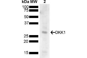 Western blot analysis of Human 293T showing detection of 28. (DKK1 antibody  (AA 120-220) (HRP))