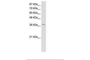 Image no. 1 for anti-Zinc Finger Protein 550 (ZNF550) (C-Term) antibody (ABIN202388) (ZNF550 antibody  (C-Term))