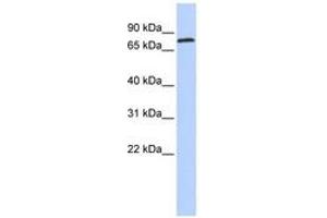 Image no. 1 for anti-Zinc Finger Protein 613 (ZNF613) (AA 35-84) antibody (ABIN6742887) (ZNF613 antibody  (AA 35-84))