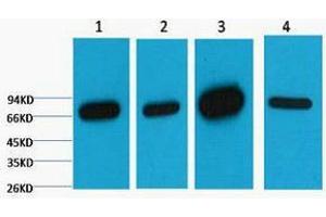 Western Blotting (WB) image for anti-Lamin B1 (LMNB1) antibody (ABIN3181108) (Lamin B1 antibody)