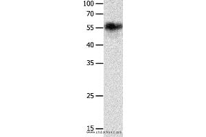 Western blot analysis of Hela cell, using CHRNA3 Polyclonal Antibody at dilution of 1:600 (CHRNA3 antibody)
