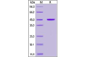 Recombinant Protein L, His Tag on  under reducing (R) condition. (Protein L Protein (His tag))