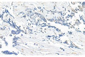 Immunohistochemistry (IHC) image for anti-Kinesin Family Member 14 (KIF14) (C-Term) antibody (ABIN7455214)