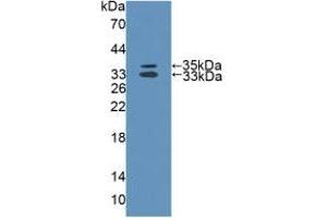 Figure. (MTUS1 antibody  (AA 1018-1270))