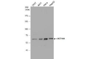 WB Image UGT1A6 antibody detects UGT1A6 protein by western blot analysis. (UGT1A6 antibody  (Center))