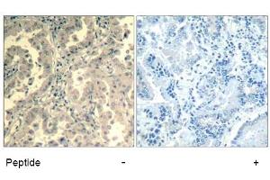 Image no. 2 for anti-Signal Transducer and Activator of Transcription 2, 113kDa (STAT2) (Tyr690) antibody (ABIN319409) (STAT2 antibody  (Tyr690))