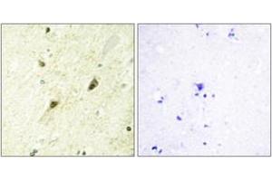 Immunohistochemistry analysis of paraffin-embedded human brain tissue, using GLI-3 Antibody. (GLI3 antibody  (AA 11-60))