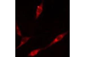 ABIN6276587 staining  A549 cells by IF/ICC. (PML antibody  (N-Term))