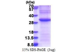 Exosome Component 4 (EXOSC4) (AA 1-245) protein (His tag)
