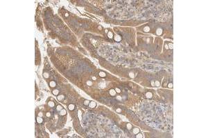 Immunohistochemical staining of human small intestine with FAM167A polyclonal antibody  shows moderate cytoplasmic positivity in glandular cells.