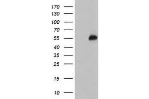 Western Blotting (WB) image for anti-Tubby Like Protein 3 (TULP3) antibody (ABIN1501586) (TULP3 antibody)