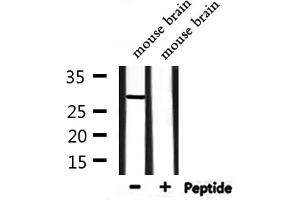 Western blot analysis of extracts from rat heart and mouse brain, using NOL7 Antibody. (NOL7 antibody  (C-Term))
