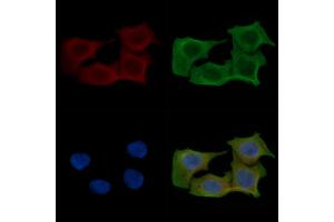 ABIN6257650 and ABIN6275616 staining Hela cells(45 min of heat-shock) by IF/ICC.