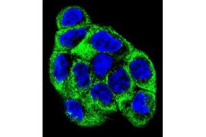 Confocal immunofluorescent analysis of ATP6V1B1 Antibody (Center) (ABIN655485 and ABIN2845006) with WiDr cell followed by Alexa Fluor 488-conjugated goat anti-rabbit lgG (green). (ATP6V1B1 antibody  (AA 284-310))