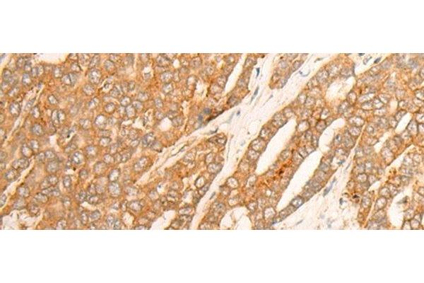 DLGAP4 antibody