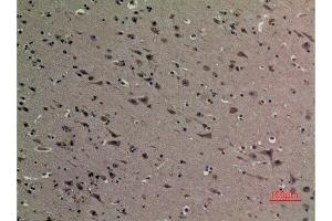 Immunohistochemistry (IHC) image for anti-High Mobility Group Box 1 (HMGB1) (acLys12) antibody (ABIN3181389)