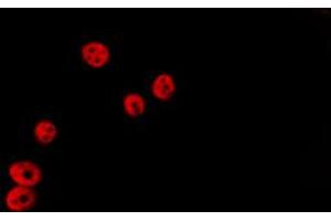 ABIN6267700 staining Hela by IF/ICC. (HDAC5 antibody  (pSer498))