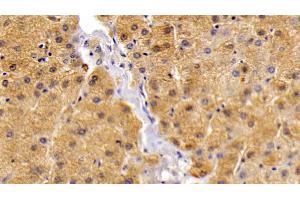 Immunohistochemistry (IHC) image for anti-Leptin Receptor (LEPR) (AA 310-539) antibody (ABIN7430873)