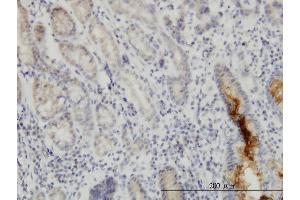 Immunoperoxidase of monoclonal antibody to NUP133 on formalin-fixed paraffin-embedded human stomach. (NUP133 antibody  (AA 1069-1155))