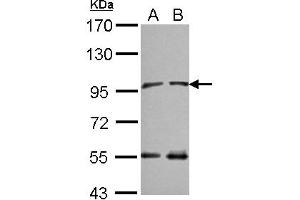 Western Blotting (WB) image for anti-N(alpha)-Acetyltransferase 15, NatA Auxiliary Subunit (NAA15) (C-Term) antibody (ABIN1491819)