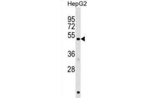 Western Blotting (WB) image for anti-Homocysteine-Inducible, Endoplasmic Reticulum Stress-Inducible, Ubiquitin-Like Domain Member 1 (HERPUD1) antibody (ABIN2999299) (HERPUD1 antibody)