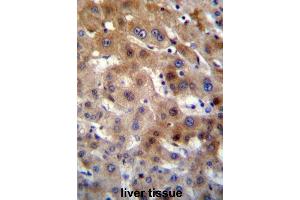 UGT2B15 Antibody (Center) immunohistochemistry analysis in formalin fixed and paraffin embedded human liver tissue followed by peroxidase conjugation of the secondary antibody and DAB staining. (UGT2B15 antibody  (Middle Region))