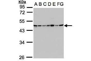 WB Image Sample(30μg whole cell lysate) A: 293T B: A431 , C: H1299 D: HeLa S3 , E: Hep G2 , F: MOLT4 , G: Raji , 10% SDS PAGE antibody diluted at 1:1000