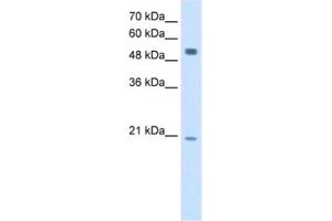 Western Blotting (WB) image for anti-B Lymphoid Tyrosine Kinase (BLK) antibody (ABIN2462928) (BLK antibody)