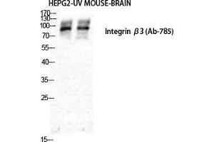 Western Blot (WB) analysis of HepG2 and Mouse Brain cells using Integrin beta3 Polyclonal Antibody. (Integrin beta 3 antibody  (Ser63))