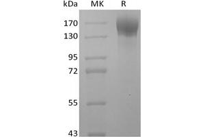 Western Blotting (WB) image for Leptin Receptor (LEPR) protein (Fc Tag) (ABIN7319902) (Leptin Receptor Protein (LEPR) (Fc Tag))