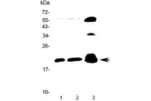 Western blot testing of 1) rat brain, 2) mouse brain and 3) human PANC1 lysate with CPI-17 antibody at 0. (CPI-17 antibody)