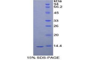 SDS-PAGE (SDS) image for C-Fos Induced Growth Factor (Vascular Endothelial Growth Factor D) (Figf) (AA 93-201) protein (His tag) (ABIN1099563) (VEGFD Protein (AA 93-201) (His tag))
