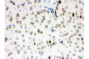 Anti- ATX2 Picoband antibody, IHC(P) IHC(P): Rat Brain Tissue (Ataxin 2 antibody  (C-Term))