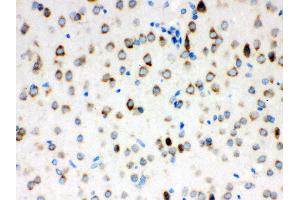 Anti- ATX2 Picoband antibody, IHC(P) IHC(P): Rat Brain Tissue (Ataxin 2 antibody  (C-Term))