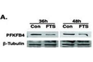 Image no. 2 for anti-6-phosphofructo-2-Kinase/fructose-2,6-Biphosphatase 4 (PFKFB4) (AA 274-303) antibody (ABIN360670) (PFKFB4 antibody  (AA 274-303))