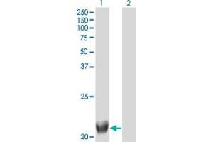 Western Blot analysis of TRIML1 expression in transfected 293T cell line by FLJ36180 monoclonal antibody (M01), clone 4F8. (TRIML1 antibody  (AA 369-468))