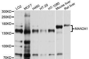 Western blot analysis of extracts of various cell lines, using MAN2A1 antibody. (alpha-Mannosidase II antibody  (AA 865-1144))