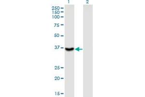 Western Blot analysis of ITGB1BP2 expression in transfected 293T cell line by ITGB1BP2 monoclonal antibody (M02), clone 3G9. (ITGB1BP2 antibody  (AA 246-319))