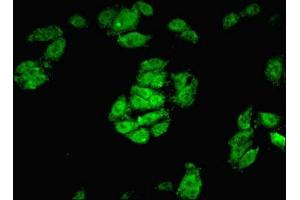 Immunofluorescent analysis of HepG2 cells using ABIN7148820 at dilution of 1:100 and Alexa Fluor 488-congugated AffiniPure Goat Anti-Rabbit IgG(H+L) (CREB3L2 antibody  (AA 1-247))