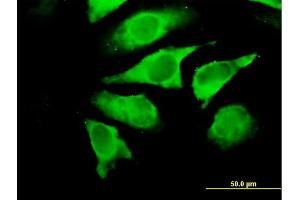 Immunofluorescence of purified MaxPab antibody to UNC119 on HeLa cell. (UNC119 antibody  (AA 1-240))