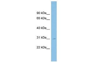 SLC39A9 antibody used at 1 ug/ml to detect target protein.